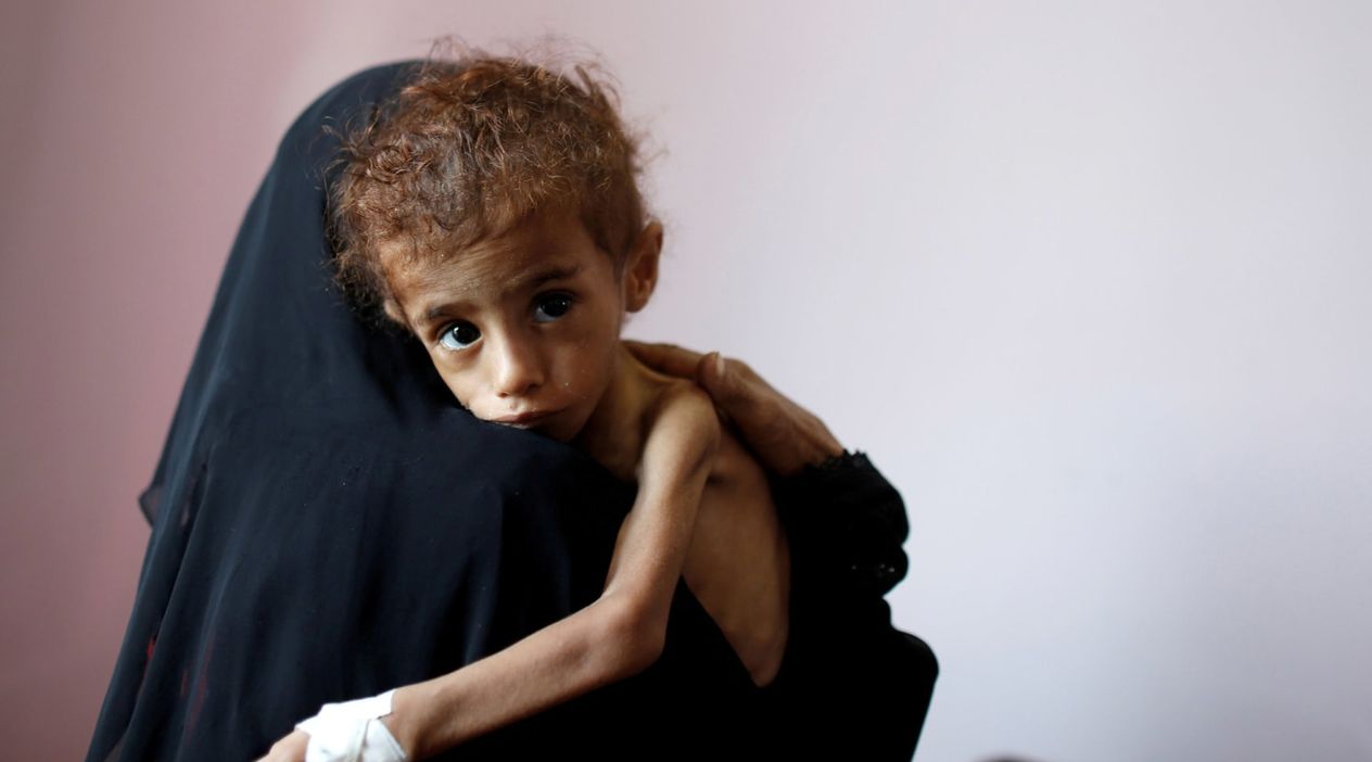 Yemen: Barış Umudunun Gölgesinde Derinleşen İnsani Felaket